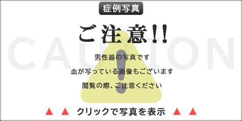 亀頭増大 銀座|亀頭増大｜包茎治療・包茎手術専門クリニッ